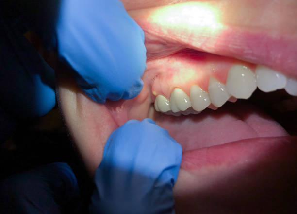 Best Pediatric Emergency Dentist in Redwood City, CA